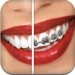 Brace Face Brace Face